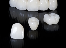 CIRKONIUMOXID het material met de beste eigenschappen voor moderne tandvervanging