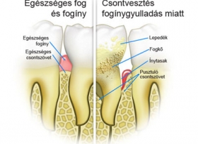 parodontológia 